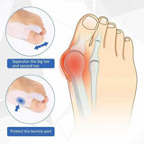 2 Silicone Gel Bunion Protector Toe Straightener Separator Alignment Pain Relief