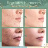 Green Tea Cleansing Facial Mask Stick Purifying Blackhead Acne Remover