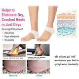 Silicone Gel Heel Socks Cracked Foot Skin Care Protector Sleeve Pain Relief