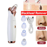 Face Facial Pore Blackhead Remover Vacuum Derma Suction Diamond Dermabrasion MN